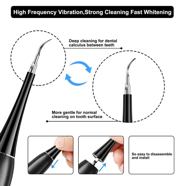 Electric tooth cleaning instrument -Teeth Cleaner