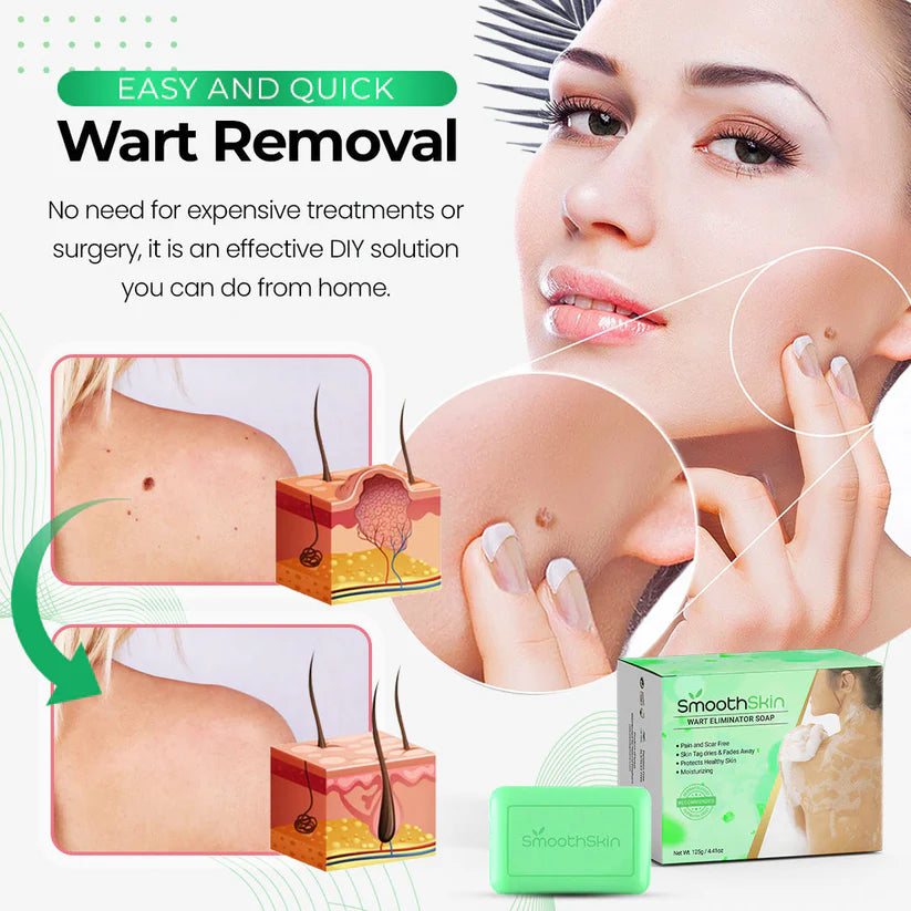 Wart Eliminator Soap