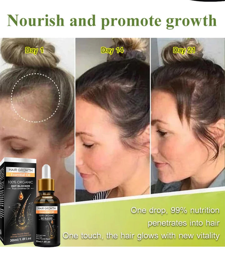 2024 NEW HAIR GROWTH ESSENTIAL OIL