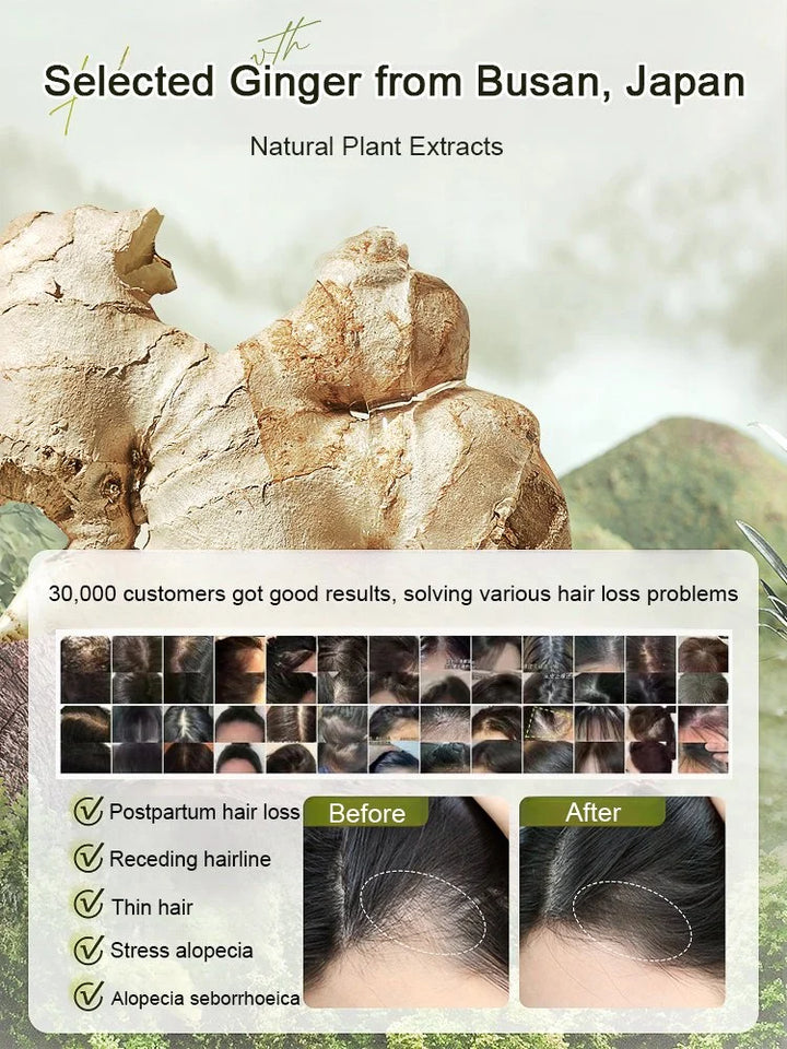 Ginger Plant Extract Anti-Hair Loss Hair Shampoo