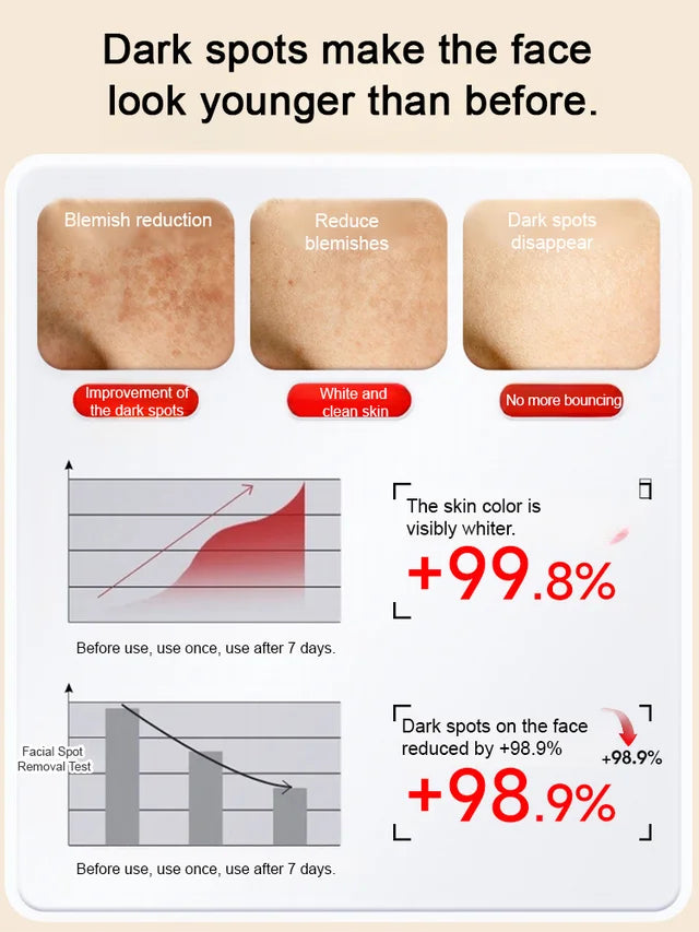 Whitening and anti-freckle essence