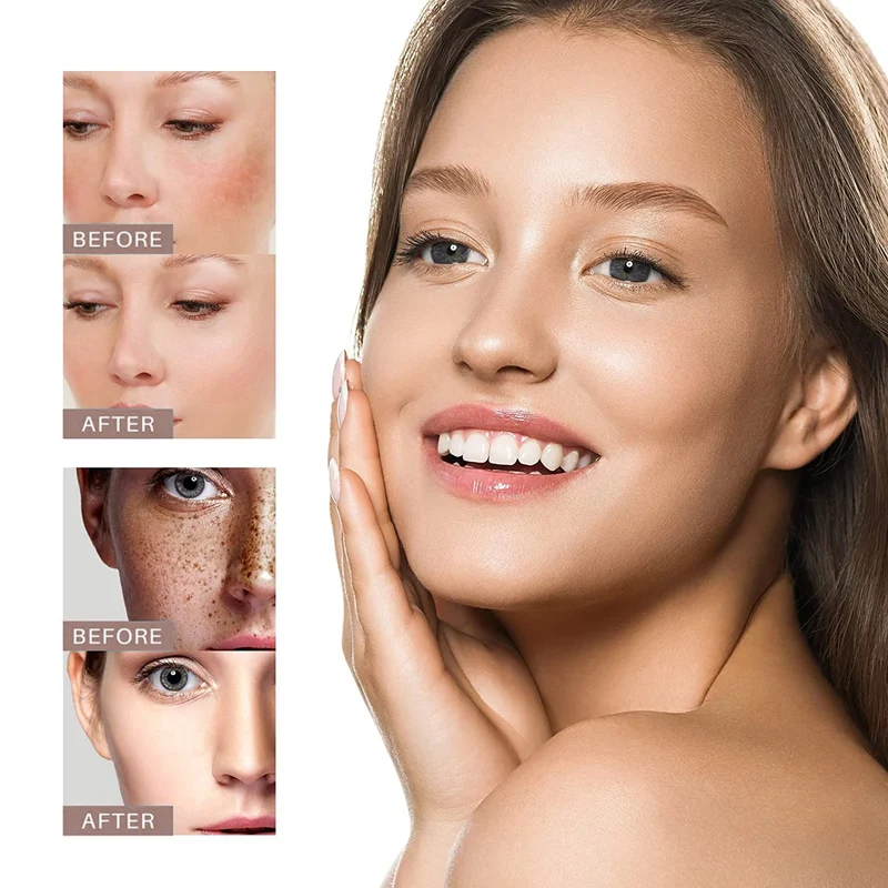 💥Big Discount Today -2024 New Anti-aging Whitening and Freckle Removal Cream