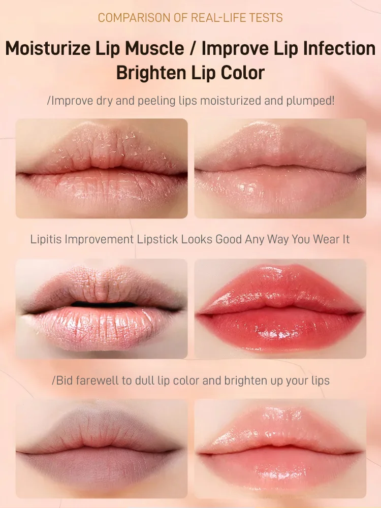 Lip Essence Oil for Light Lines and Color Changes