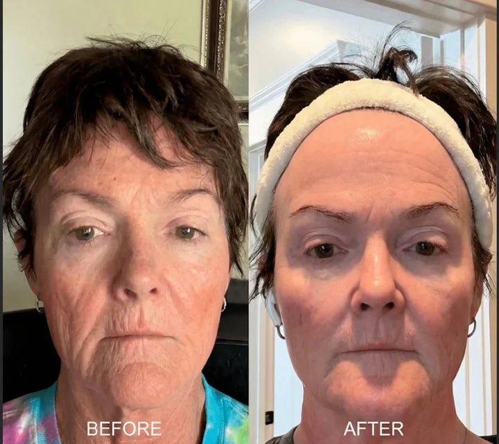 ⏰ Last 3 Hours! 🔥 Buy 1 Get 1 Free Deep Collagen Cream In Serum