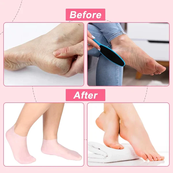 MOISTURIZING FOOT MASK EXFOLIATING SILICONE SOCKS BEACH PROTECTIVE SOCKS