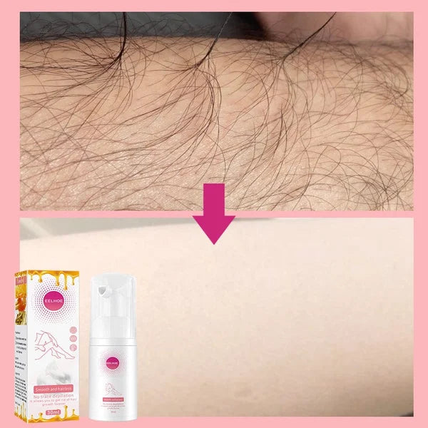 Smooth as Honey: Mousse Hair Removal Spray