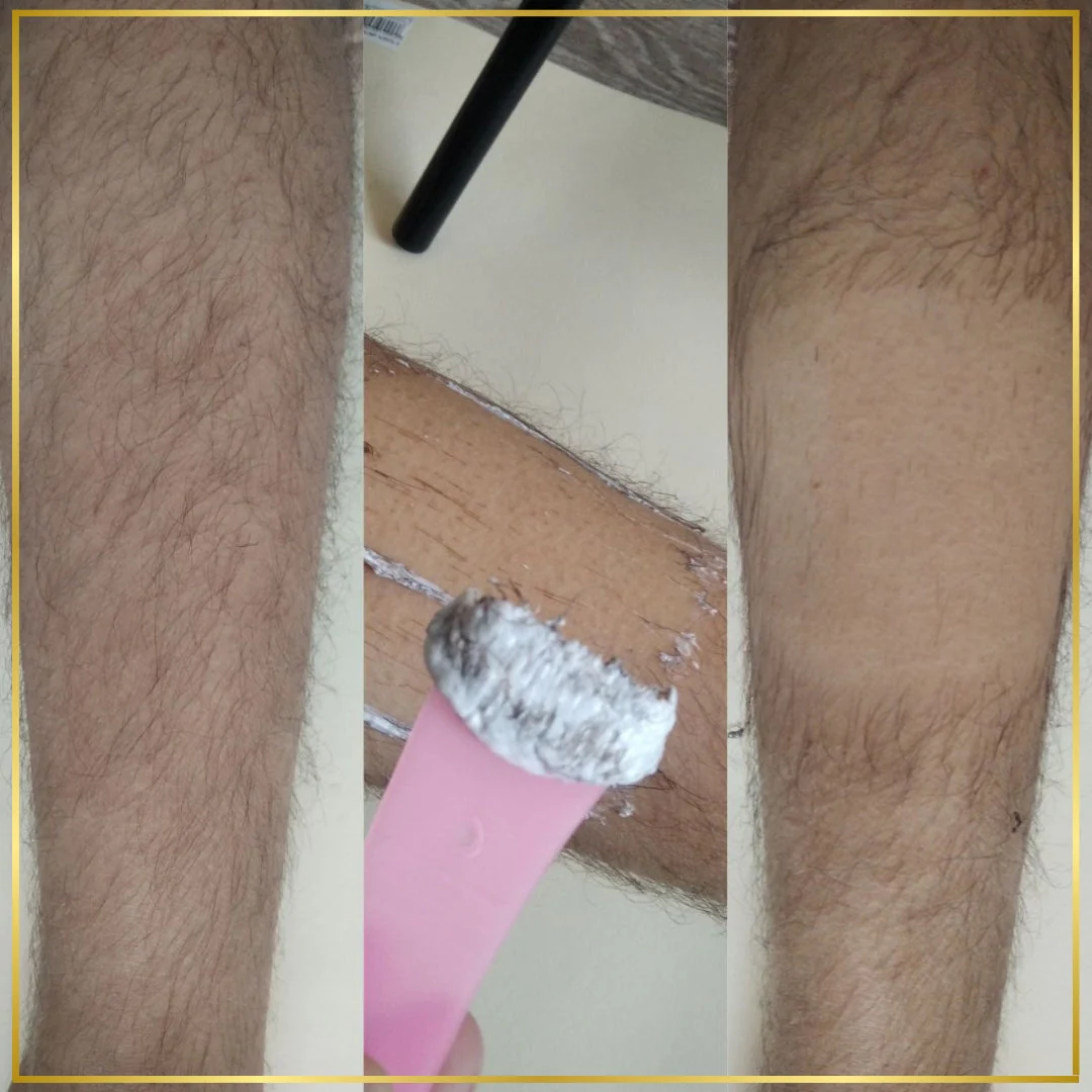 Hair Removal Cream