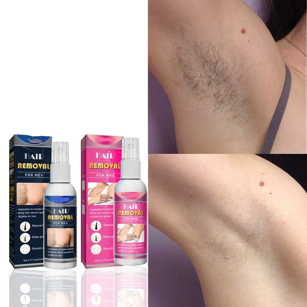 🔥BIG SALE - HALF PRICE🔥🔥Body Hair Removal Spray