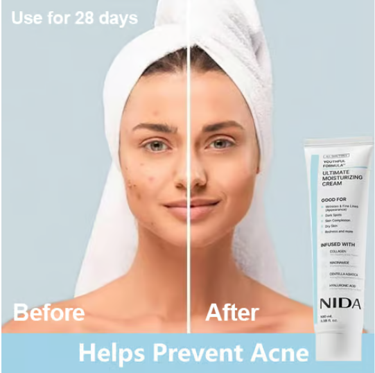 🎉Hot Sale 49% OFF🎉-NIDA Youthful Formula Ultimate Moisturizing Cream