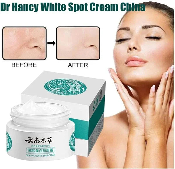 🌿JP.HANCY Yunnan Herbal Whitening and Freckle-Removing Cream: Fades Spots and Brightens Skin Tone 🌟