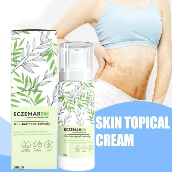 Eczemaron Anti Fungal Cream (BUY 1 GET 1 FREE)