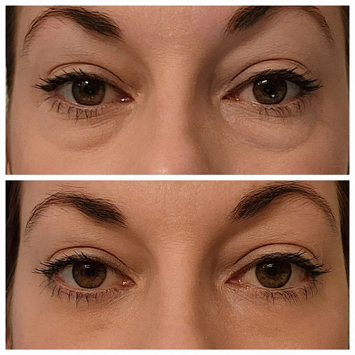 🔥Last Day 49% OFF🎁Instant Eye Temporary Eye Tightener