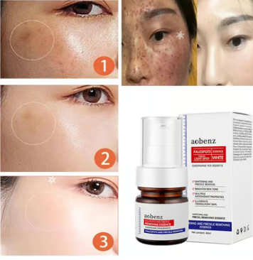 Vitamin C Whitening Freckles Face Cream Remove Melasma Dark Spots Lighten Melanin