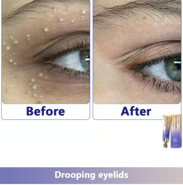 Collagen+Ball eye cream Roll-on