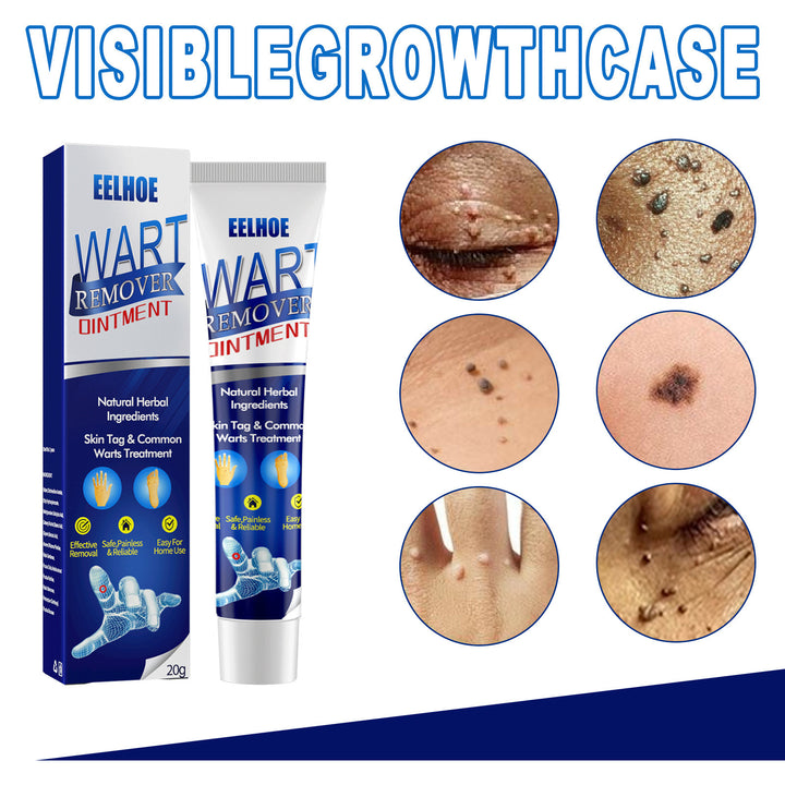 Wart Remover Gel