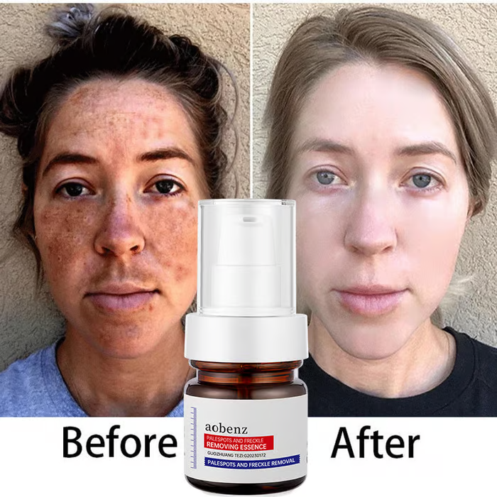 🔥Vitamin C Whitening Freckles Face Cream Remove Melasma Dark Spots Lighten Melanin