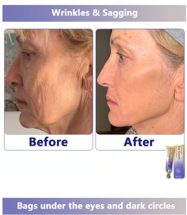 Collagen+Ball eye cream Roll-on
