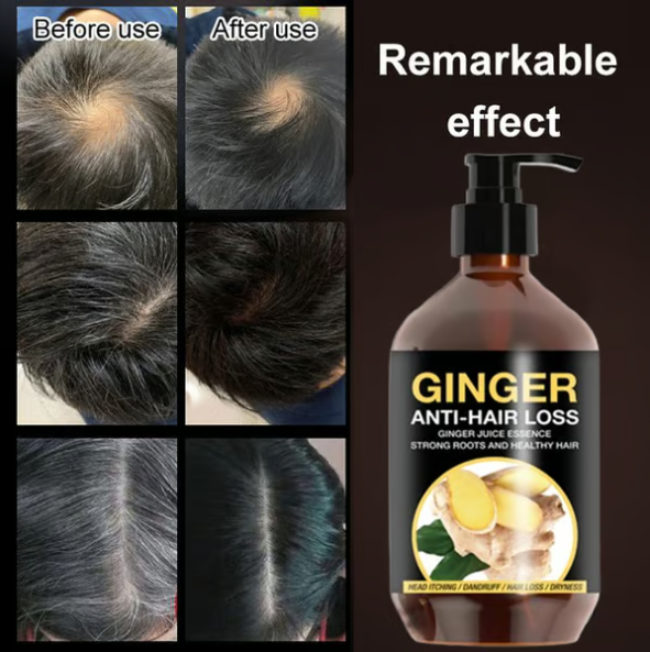 Anti-hair loss shampoo