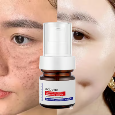 Vitamin C Whitening Freckles Face Cream Remove Melasma Dark Spots Lighten Melanin