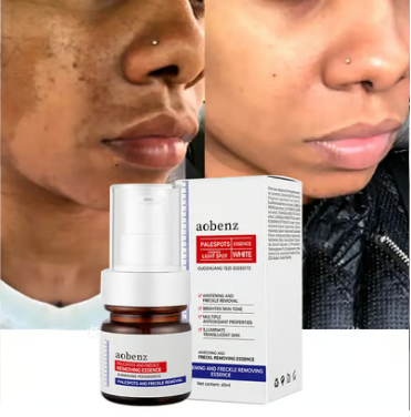 Vitamin C Whitening Freckles Face Cream Remove Melasma Dark Spots Lighten Melanin