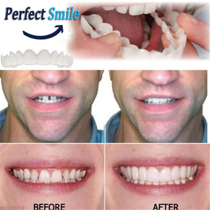 Adjustable Snap On Dentures