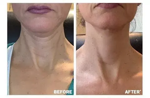 Advanced Neck Firming Cream