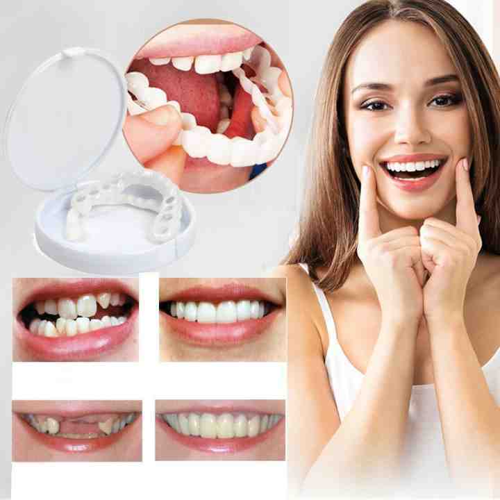 Adjustable Snap On Dentures