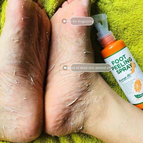 Callus Off Foot Reglow Spray