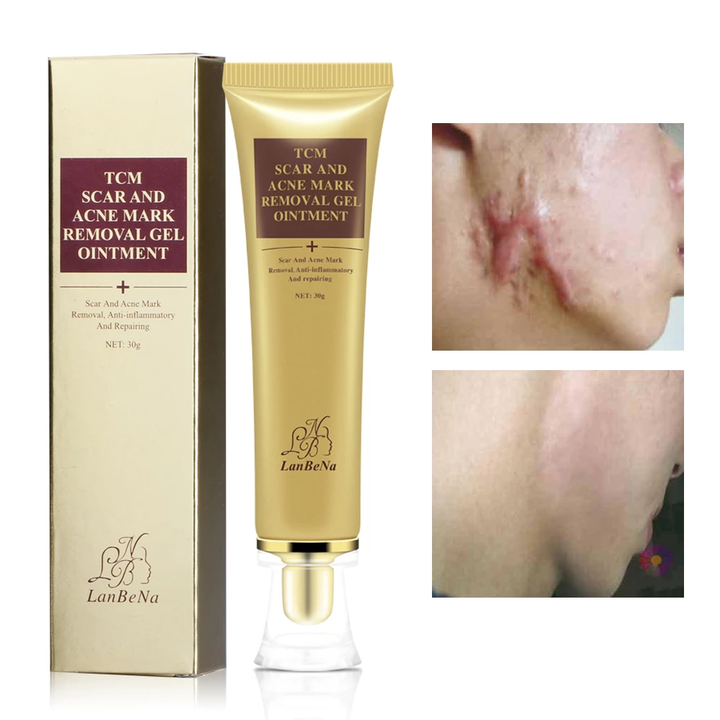 Acne Scar Removal Cream Gel Skin Repair Smoothing Spots Acne Treatment Blackhead Whitening repair Stretch Marks 30ml