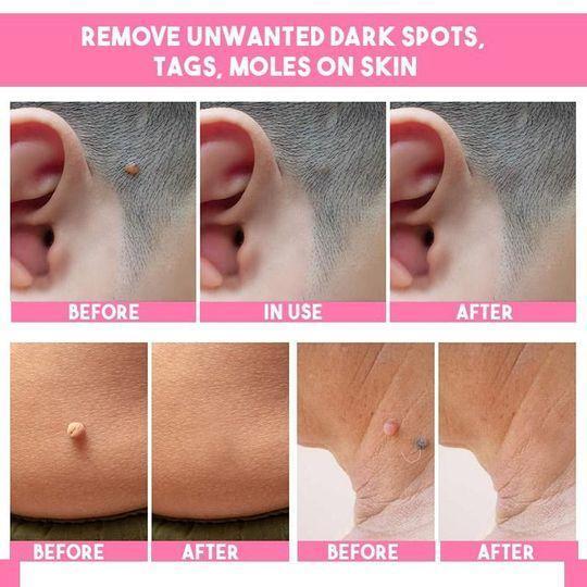 Organic Skin Spot purifying Serum