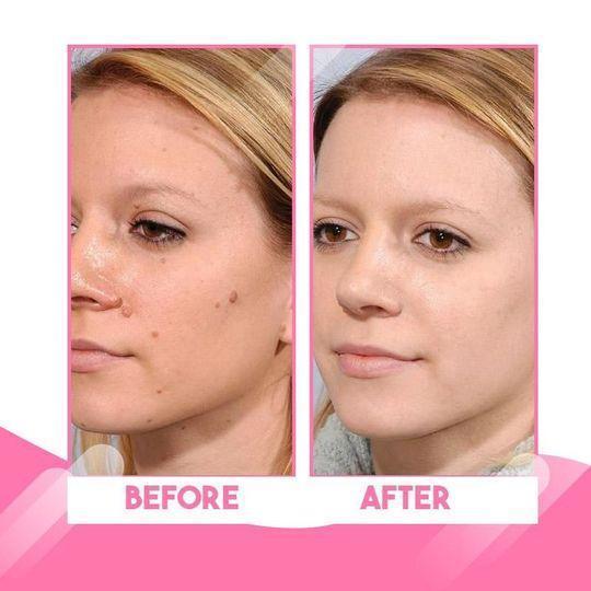 Organic Skin Spot purifying Serum