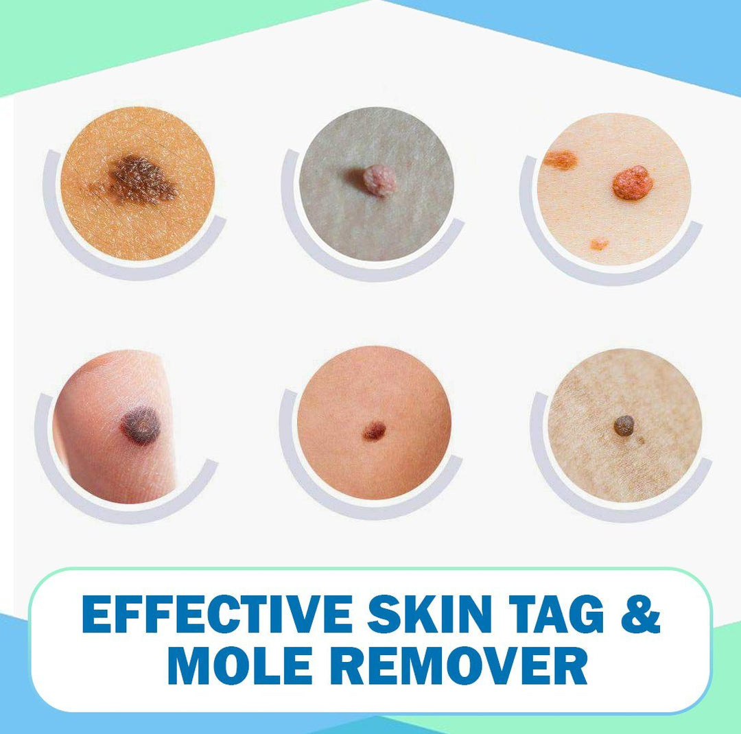 WipeOff  Tags   Moles Remover