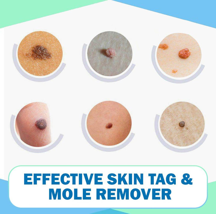 WipeOff  Tags   Moles Remover