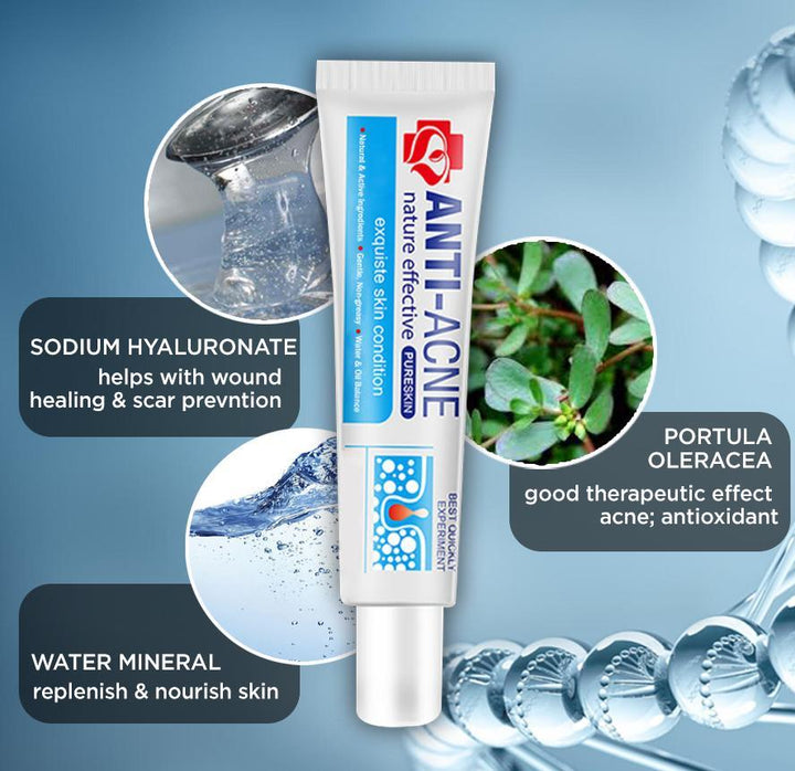 AcneClear Blemish Removal Cream