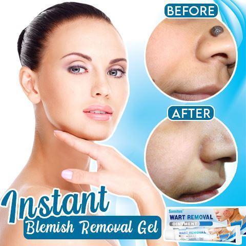 WartsOff Instant Blemish Removal Cream