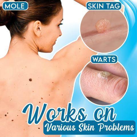 WartsOff Instant Blemish Removal Cream