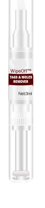 WipeOff  Tags   Moles Remover